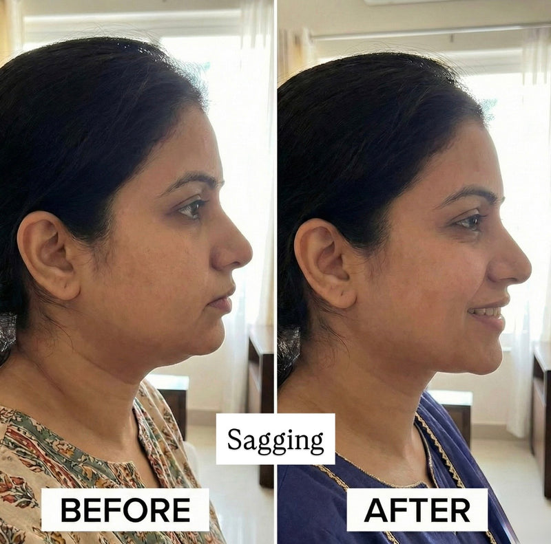 Morning puffiness reduced within 4 weeks — Aarti, 32