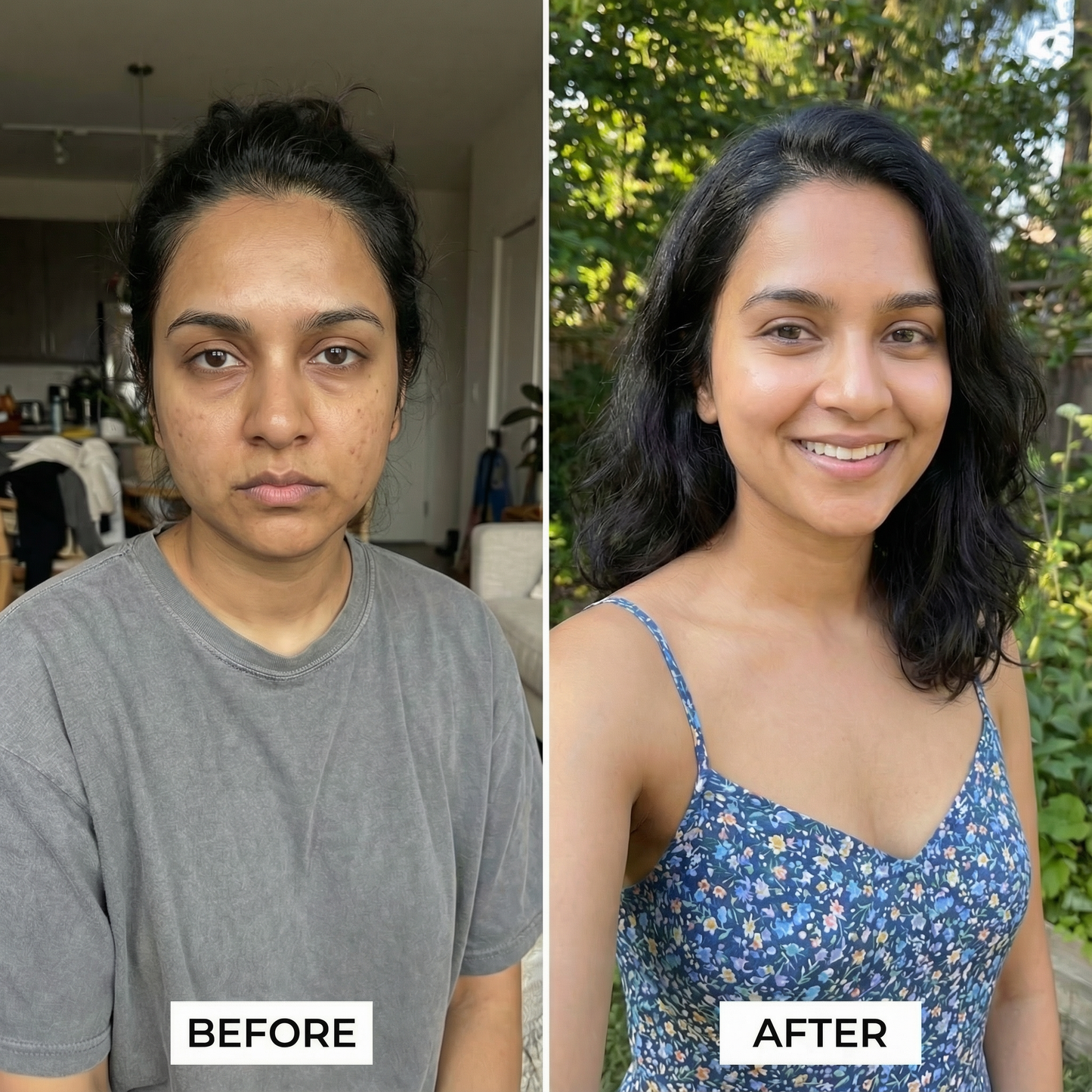 Your Personalized Face Analysis & Daily Face Yoga Plan